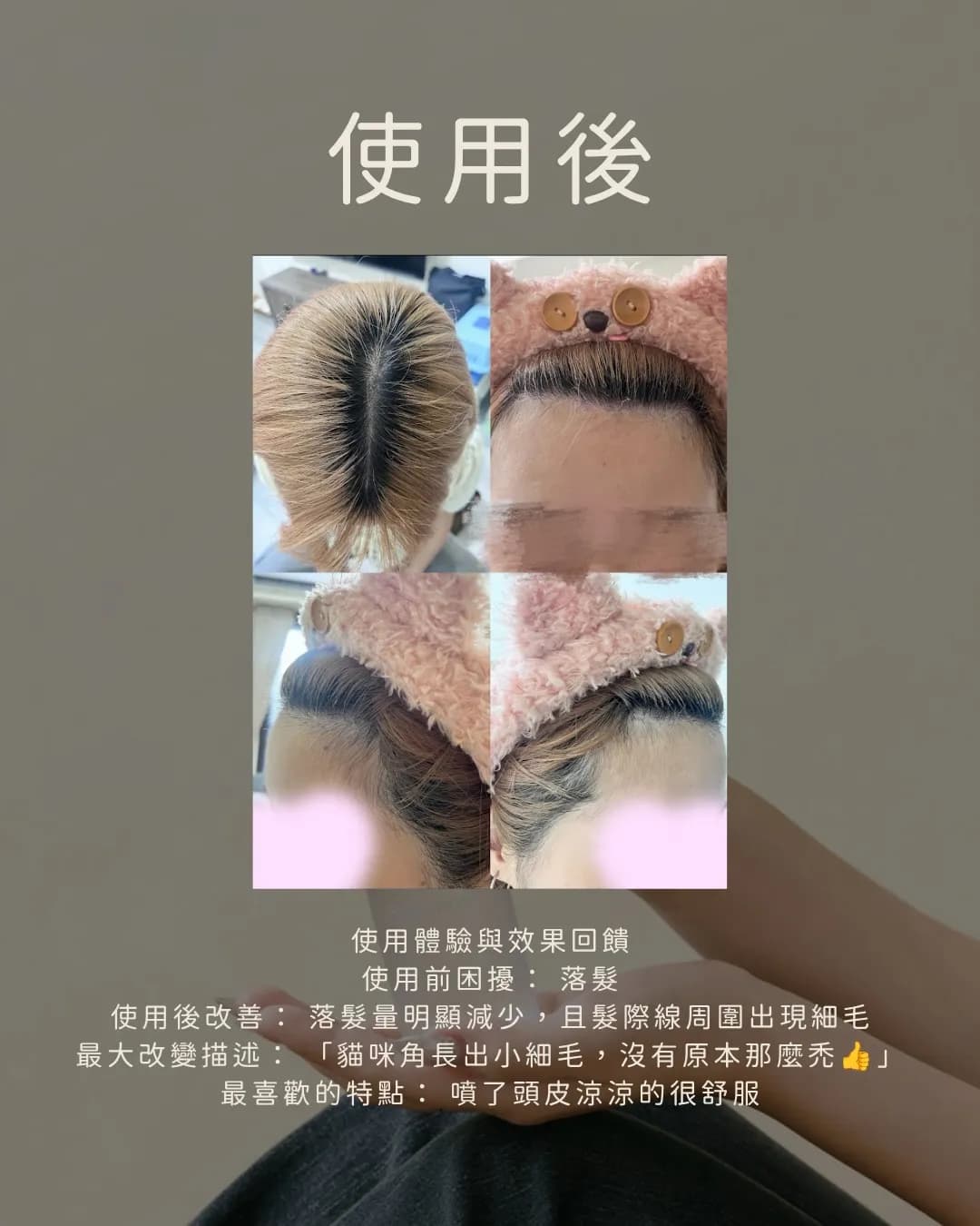 展示使用前後效果的圖片,顯示頭髮狀況。